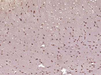 P38 MAPK/ MAPK14 Rabbit Polyclonal Antibody