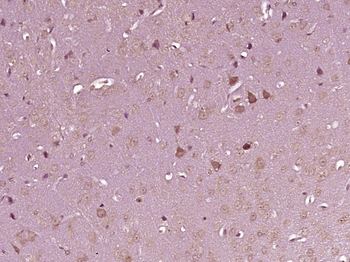 Caspase-6 subunit p11 Rabbit Polyclonal Antibody