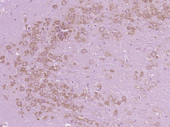 Caspase-6 subunit p11 Rabbit Polyclonal Antibody