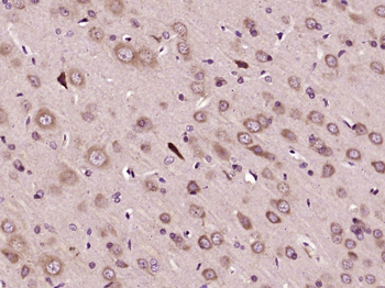 PER2 Rabbit Polyclonal Antibody