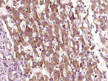 GST1 Rabbit Polyclonal Antibody