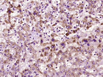 GST1 Rabbit Polyclonal Antibody
