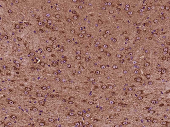 14-3-3/YWHAZ Mouse Monoclonal Antibody