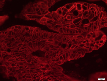 CK16 Mouse Monoclonal Antibody