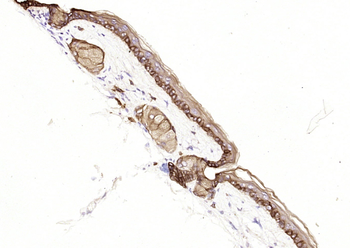 CK16 Mouse Monoclonal Antibody