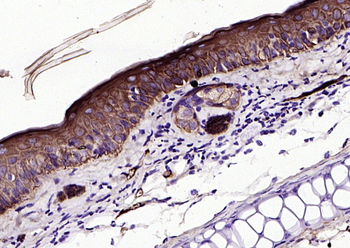 CK16 Mouse Monoclonal Antibody