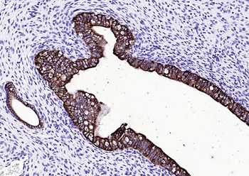 CK16 Mouse Monoclonal Antibody
