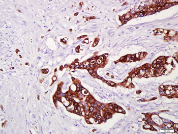 CK16 Mouse Monoclonal Antibody