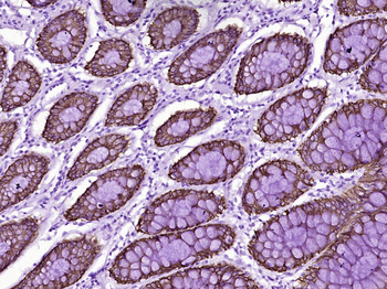 CK16 Mouse Monoclonal Antibody