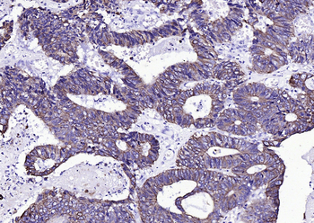 CK16 Mouse Monoclonal Antibody