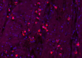 CK16 Mouse Monoclonal Antibody