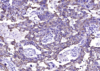 CK16 Mouse Monoclonal Antibody