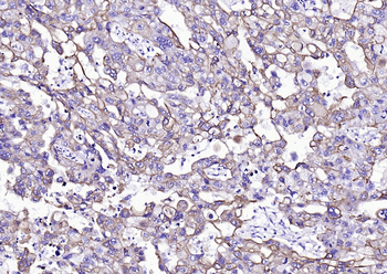 CK16 Mouse Monoclonal Antibody