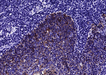 CK16 Mouse Monoclonal Antibody