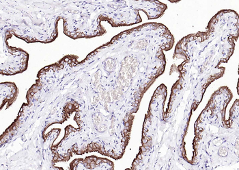 CK7 Mouse Monoclonal Antibody