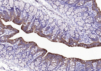 CK7 Mouse Monoclonal Antibody