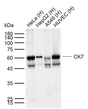 CK7 Mouse Monoclonal Antibody