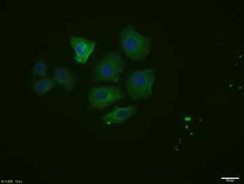 CK7 Mouse Monoclonal Antibody
