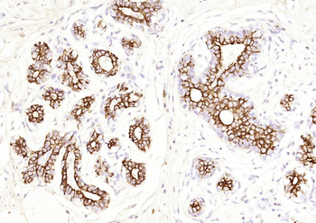 CK7 Mouse Monoclonal Antibody