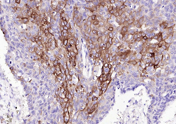 CK7 Mouse Monoclonal Antibody