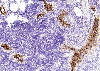 CK7 Mouse Monoclonal Antibody