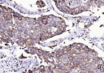 CK7 Mouse Monoclonal Antibody