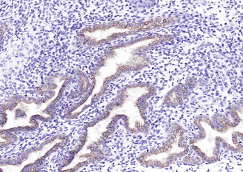 CK7 Mouse Monoclonal Antibody