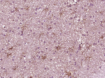 JAK1 Mouse Monoclonal Antibody