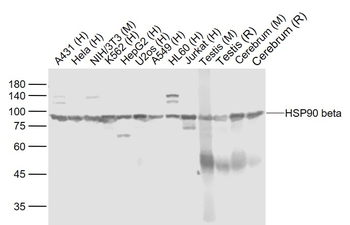 HSP90 beta Mouse Monoclonal Antibody