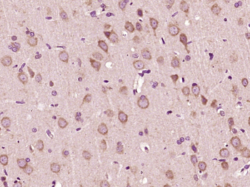 VEGFA Rabbit Polyclonal Antibody