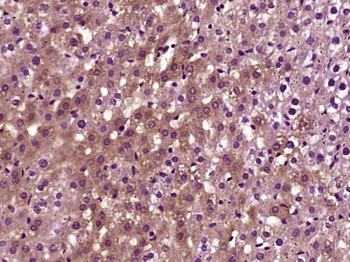 VEGFA Rabbit Polyclonal Antibody