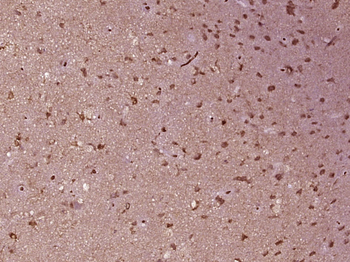 EGFR Mouse Monoclonal Antibody