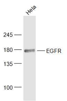 EGFR Mouse Monoclonal Antibody