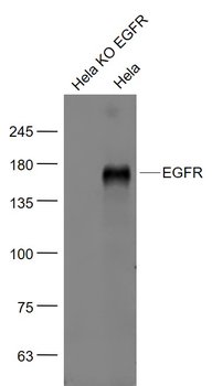 EGFR Mouse Monoclonal Antibody
