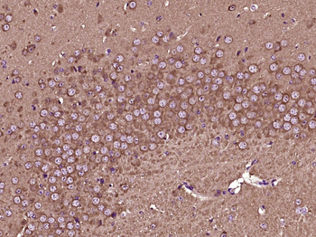 GSK-3 Beta Mouse Monoclonal Antibody