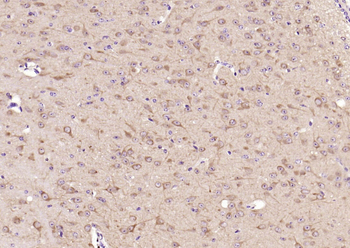 GSK-3 Beta Mouse Monoclonal Antibody