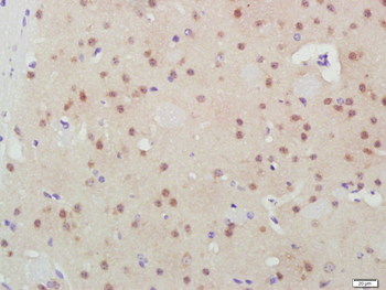 GSK-3 Beta Mouse Monoclonal Antibody