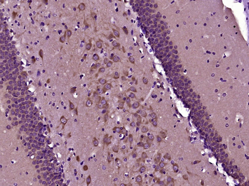 GSK-3 Beta Mouse Monoclonal Antibody