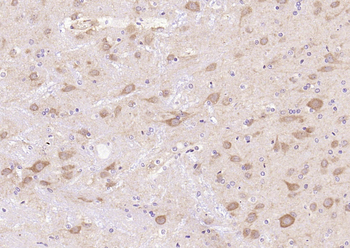 GSK-3 Beta Mouse Monoclonal Antibody