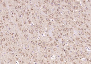 GSK-3 Beta Mouse Monoclonal Antibody