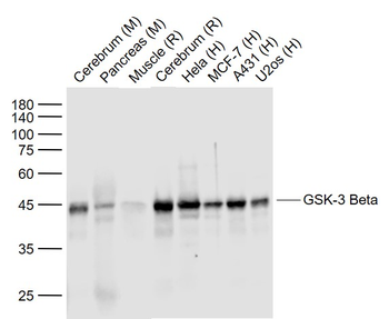 GSK-3 Beta Mouse Monoclonal Antibody
