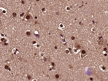 HES5 Rabbit Polyclonal Antibody