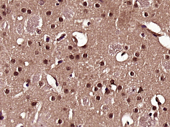 HES5 Rabbit Polyclonal Antibody