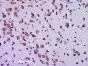 PIK3R1 Rabbit Polyclonal Antibody