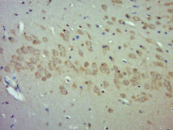 PIK3R1 Rabbit Polyclonal Antibody