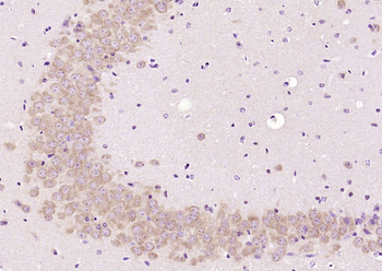 PKC delta Rabbit Polyclonal Antibody