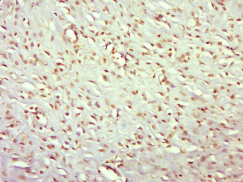 EPB41 Rabbit Polyclonal Antibody