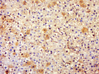 EPB41 Rabbit Polyclonal Antibody