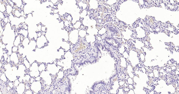 S100B Mouse Monoclonal Antibody