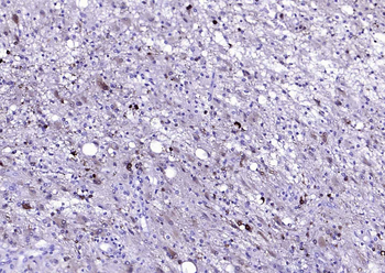 S100B Mouse Monoclonal Antibody